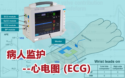 病人监护--心电图 (ECG)